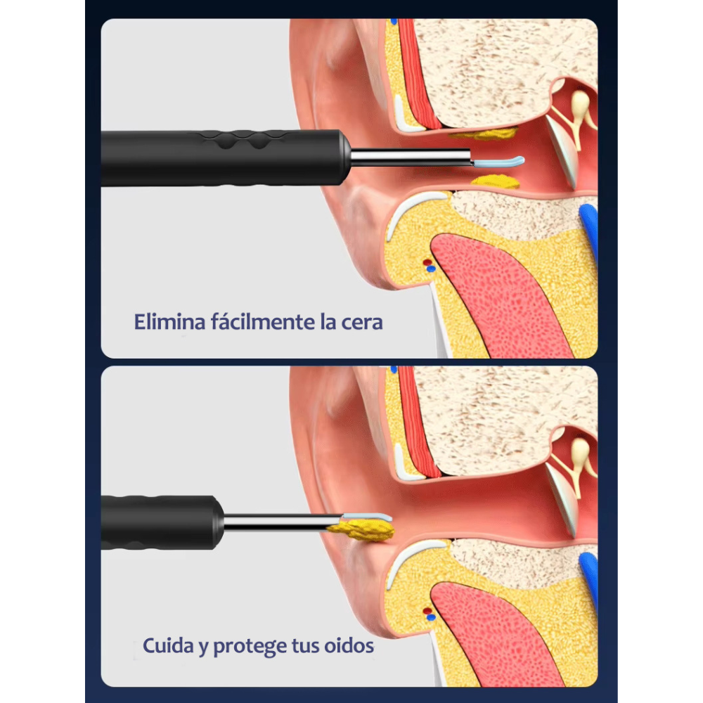 Limpiador oídos con cámara
