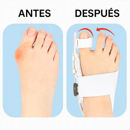 2x1 FlexiStep® : Corrector de juanete ortopédico